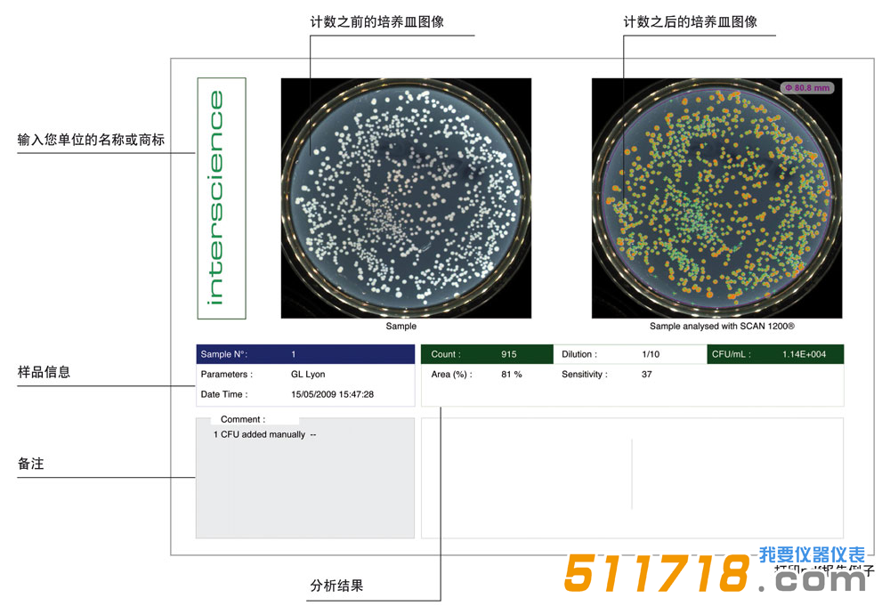 法國interscience Scan 300全自動菌落計數器2.png