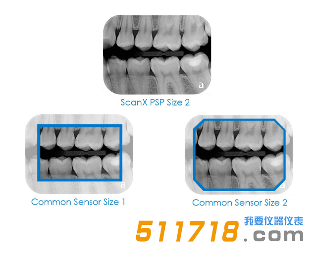 美國AIR TECHNIQUES ScanX Duo數字X射線系統 口腔掃描儀2.png